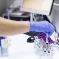 Blood tubes at the microbiology laboratory.