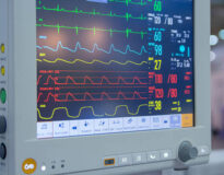 Results of clinical examinations on the monitor screen. Medical equipment